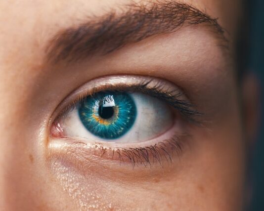 Can psoriasis affect the eyes?